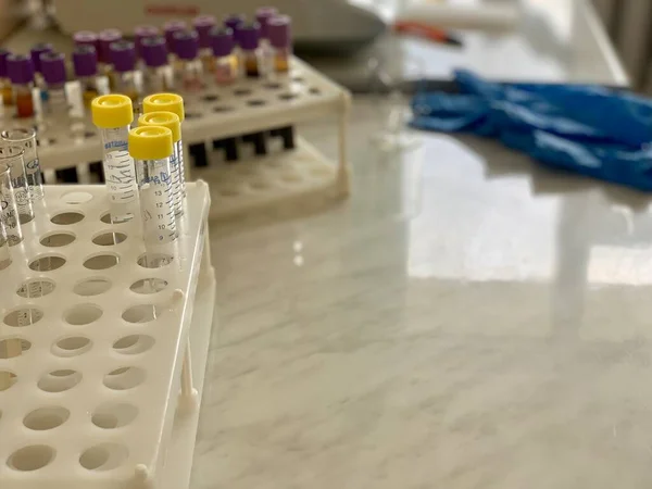Test Tubes Blood Stand Rack Laboratory Analysis — Photo