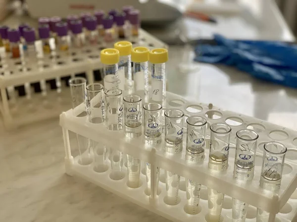 Test Tubes Blood Close Laboratory Plastic Box Holder Laboratory Research — Photo