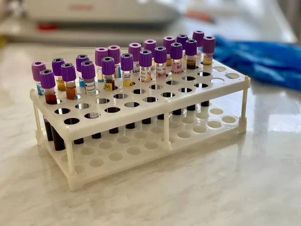 Багато Трубок Крові Лабораторного Аналізу — стокове фото