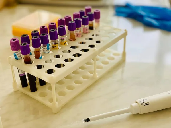 Тестові Трубки Кров Крупним Планом Лабораторії Тримачі Пластикової Коробки Лабораторні — стокове фото
