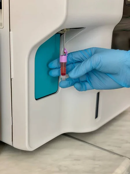 血液分析器だ 試験管から研究のために血液を採取するプロセス 血液でチューブをテスト 血液学分析器 — ストック写真