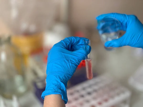 Tudósok Vérmintákon Végeznek Laboratóriumi Vizsgálatokat Vérvizsgálati Csövek — Stock Fotó