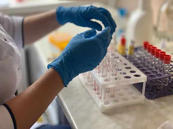 Tudósok Vérmintákon Végeznek Laboratóriumi Vizsgálatokat Vérvizsgálati Csövek — Stock Fotó