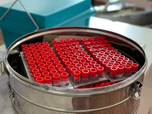 Tubes Laboratoire Avec Bouchons Rouges Dans Valise Transport — Photo