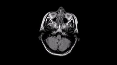 RM beyin yetenek Aksiyel uzun tr,