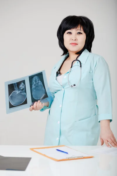 Young female Asian doctor looking straight with the x-ray pictur
