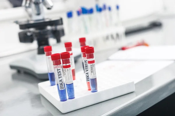 Análise do vírus Zika em laboratório — Fotografia de Stock