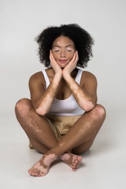 Vitiligo hastalığı olan kıvırcık kadın. Gözleri ve bacakları kapalı oturuyor.