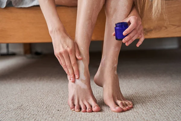 Žena sedí v posteli u svého bytu a nanáší krém na nohy — Stock fotografie