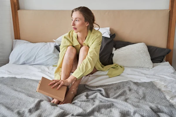 Meisje met vitiligo huid kijken naar het raam tijdens het lezen boek thuis — Stockfoto