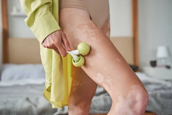 Mulher com pele vitiligo usando rolo de jade na pele da perna enquanto sentado em casa — Fotografia de Stock