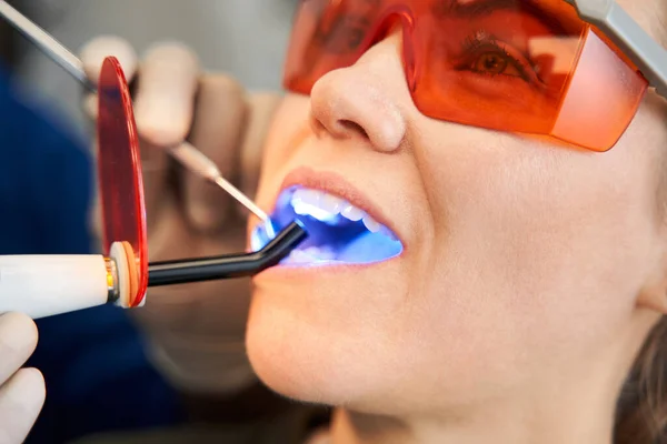 El dentista ilumina al paciente la lámpara ultravioleta sobre el relleno del diente —  Fotos de Stock