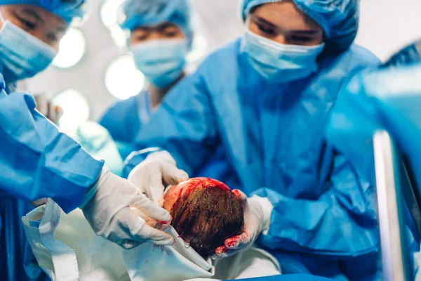 Professionelle Anästhesist Arzt Medizinisches Team Und Assistent Führt Baby Kaiserschnitt — Stockfoto