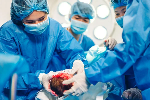 Professionelle Anästhesisten Ärzteteam Und Assistentin Führen Baby Kaiserschnitt Durch Und — Stockfoto