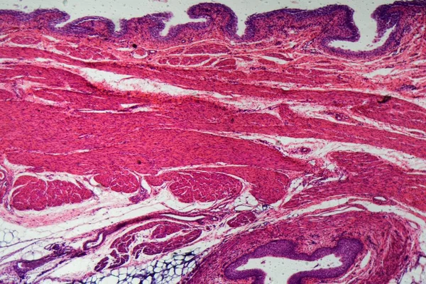 Células Del Epitelio Transición Humano Bajo Microscopio — Foto de Stock