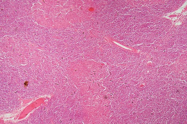 현미경 아래에 흉선의 세포들 사이로 — 스톡 사진