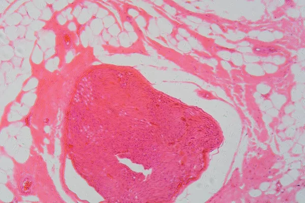 Een Doorsnede Van Menselijke Zenuwcellen Onder Microscoop — Stockfoto