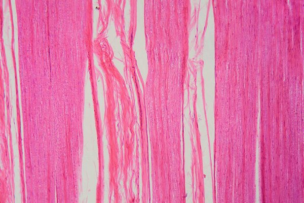 Продольная часть нервных клеток человека под микроскопом. 