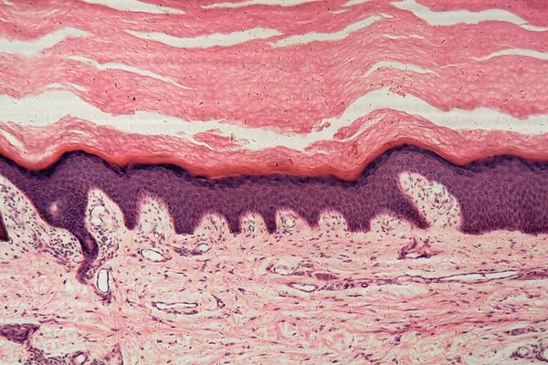 显微镜下带汗腺的人类皮肤 — 图库照片