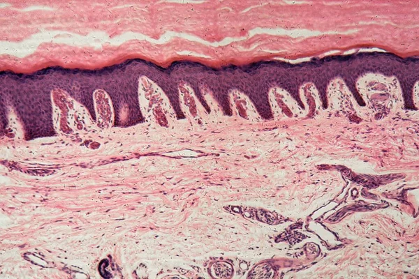 Menschliche Haut Mit Schweißdrüsen Unter Dem Mikroskop — Stockfoto