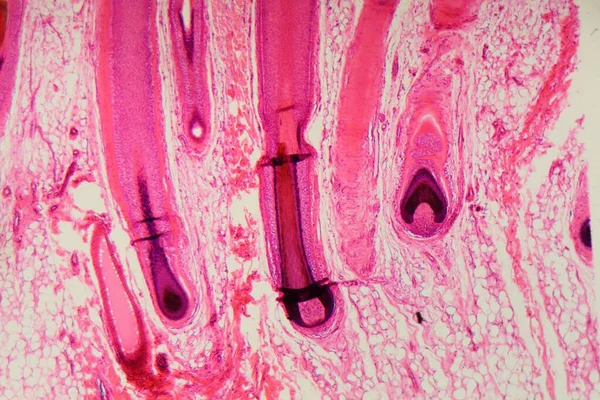 Secțiunea Unui Folicul Păr Uman Piele Sub Microscop — Fotografie, imagine de stoc