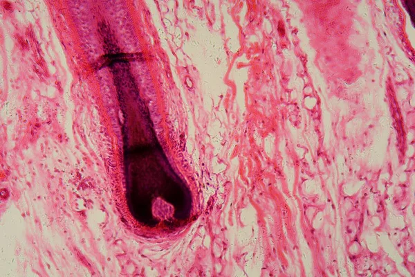 Section of a human hair follicle in skin under the microscope