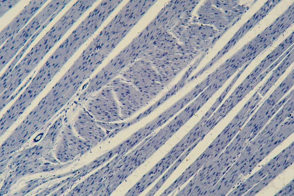 Section of a human cardiac muscle under the microscope.