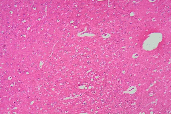 Secção Cérebro Humano Microscópio — Fotografia de Stock