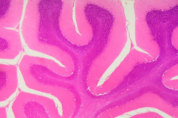 Mikroskop Altında Bir Insan Beyinciğinin Parçası — Stok fotoğraf