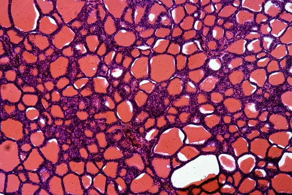 Τμήμα Των Κυττάρων Του Θυρεοειδούς Αδένα Στο Μικροσκόπιο — Φωτογραφία Αρχείου