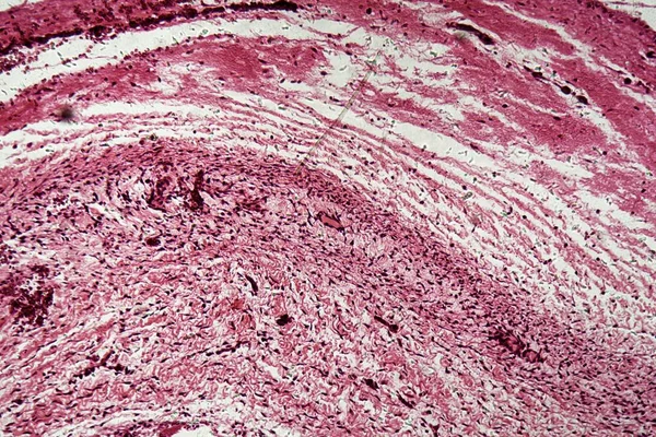 Кость Человеческого Зародыша Микроскопом — стоковое фото