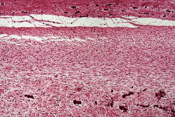 Osso Uma Cabeça Fetal Humana Microscópio — Fotografia de Stock