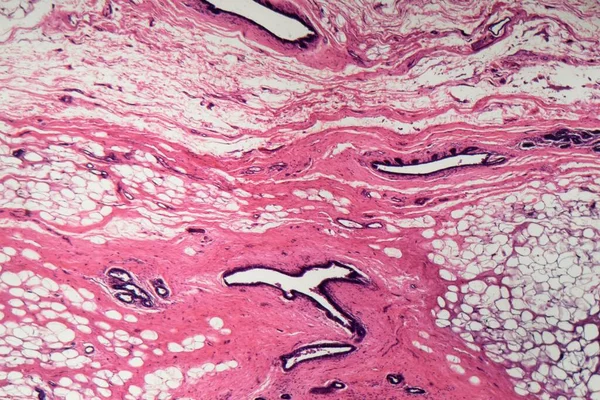 Sectie Van Menselijke Borstkliercellen Onder Microscoop — Stockfoto