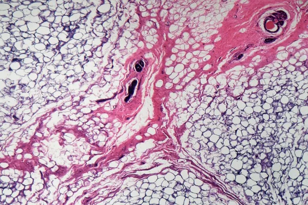 Sekcja Ludzkich Komórek Sutka Pod Mikroskopem — Zdjęcie stockowe