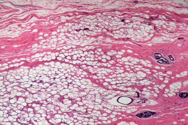显微镜下人类乳腺细胞切片 — 图库照片