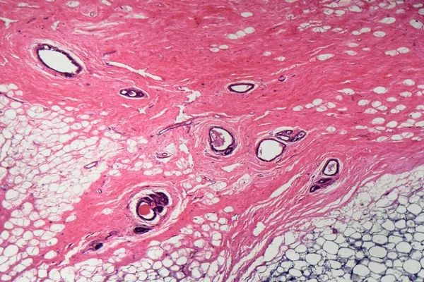 Τμήμα Των Κυττάρων Του Ανθρώπινου Μαστικού Αδένα Στο Μικροσκόπιο — Φωτογραφία Αρχείου
