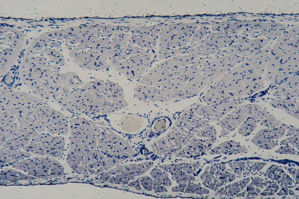 Human skeletal muscle cells under the microscope