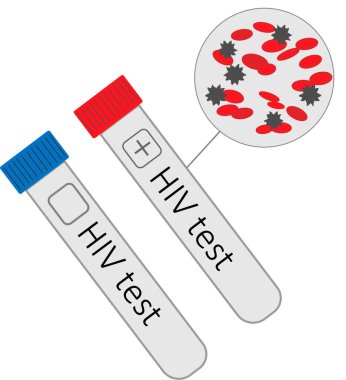 AIDS günü. Salgından etkilenen insanları destekleyin. Hastalıkla mücadele etmenin önemini tüm dünyaya aktarın; insanları test yaptırmaya, HIV durumlarını öğrenmeye ve HIV önleme, tedavi ve bakım hizmetleri almaya motive edin.. 