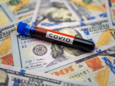 100 doların üzerinde kan örneği. Tıbbi konsept.