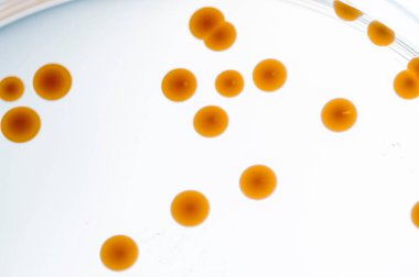 Laboratuvara yerleştirilen bakteri görüntüsü