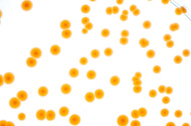 Laboratuvara yerleştirilen bakteri görüntüsü