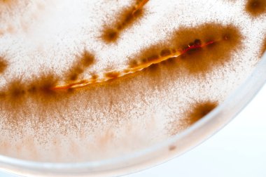 Laboratuvara yerleştirilen bakteri görüntüsü