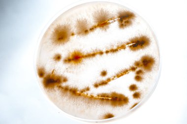 Laboratuvara yerleştirilen bakteri görüntüsü