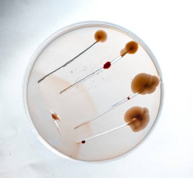 Laboratuvara yerleştirilen bakteri görüntüsü