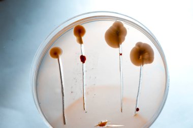 Laboratuvara yerleştirilen bakteri görüntüsü