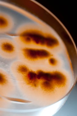 Laboratuvara yerleştirilen bakteri görüntüsü