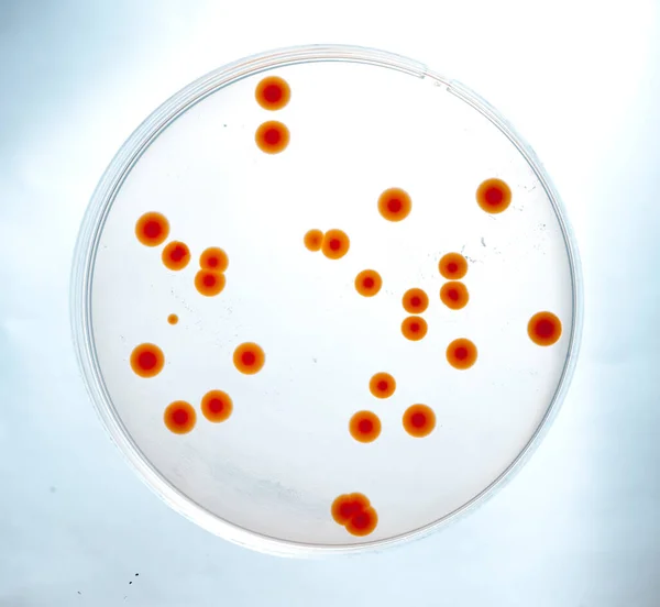 Imagen Bacterias Laboratorio Colocadas Receptáculo — Foto de Stock