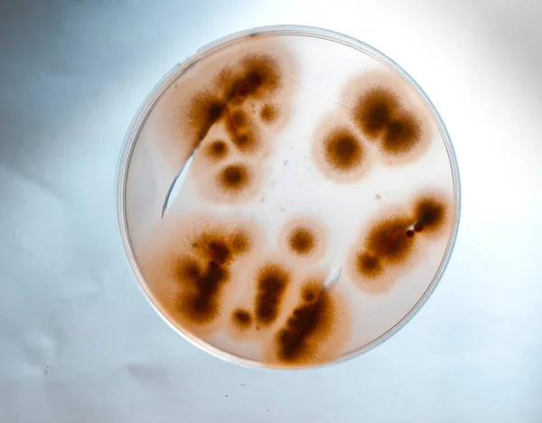 실험실에 박테리아의 모습을 그릇에 — 스톡 사진