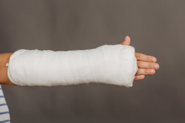 Kırık bir kol alçıda gri arka plan üzerinde Close-Up. Medicin