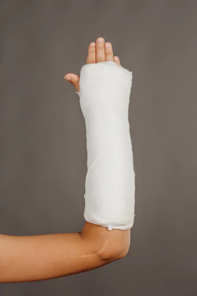 ᐈ Arm in cast stock pictures, Royalty Free arm cast pics | download on Depositphotos®